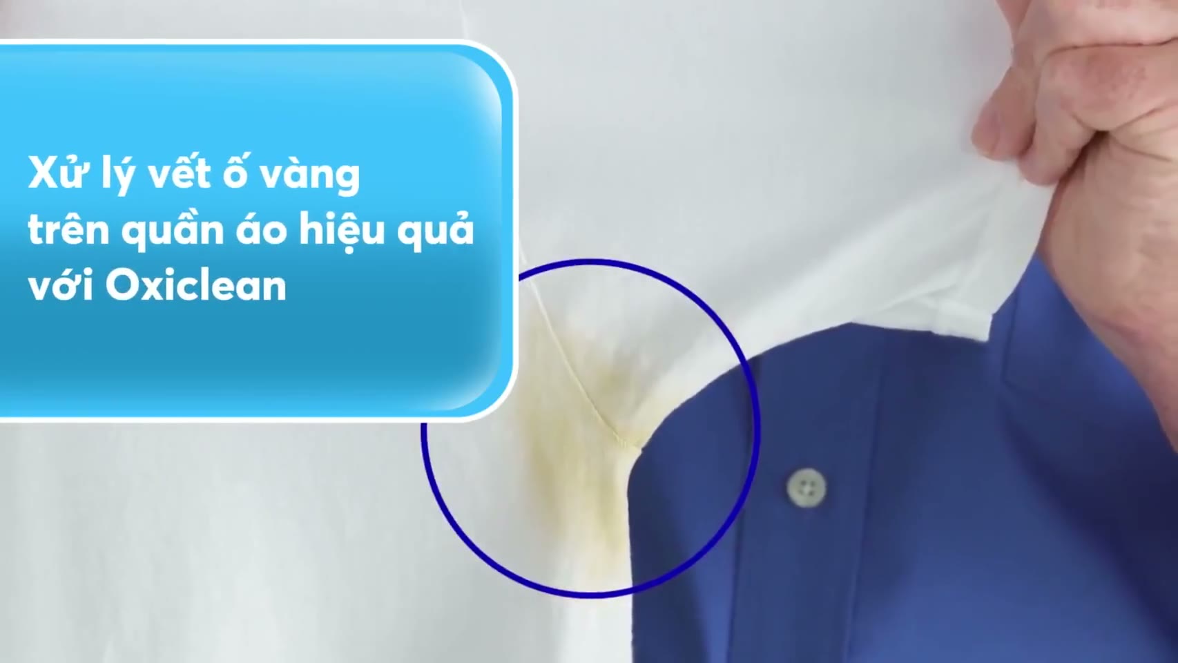 Tẩy ố vàng áo trắng OxiClean